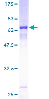 12.5% SDS-PAGE Stained with Coomassie Blue.